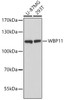 Western blot analysis of extracts of various cell lines using WBP11 Polyclonal Antibody at dilution of 1:3000.