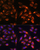 Immunofluorescence analysis of U-2 OS cells using PTCD1 Polyclonal Antibody at dilution of  1:100. Blue: DAPI for nuclear staining.