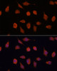 Immunofluorescence analysis of L929 cells using KCNAB2 Polyclonal Antibody at dilution of  1:100. Blue: DAPI for nuclear staining.