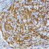 Immunohistochemistry of paraffin-embedded Human tonsil using CSNK1A1 Polyclonal Antibody at dilution of  1:100 (40x lens).