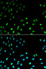 Immunofluorescence analysis of MCF-7 cells using RFC1 Polyclonal Antibody
