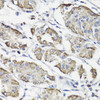 Immunohistochemistry of paraffin-embedded Human stomach using WASF3 Polyclonal Antibody at dilution of  1:100 (40x lens).
