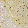 Immunohistochemistry of paraffin-embedded Rat brain using FSP1/S100A4 Polyclonal Antibody at dilution of  1:100 (40x lens).