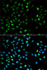 Immunofluorescence analysis of HeLa cells using DTNBP1 Polyclonal Antibody