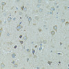 Immunohistochemistry of paraffin-embedded Rat brain using HSPB1 Polyclonal Antibody at dilution of  1:100 (40x lens).