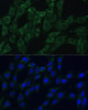 Immunofluorescence analysis of C6 cells using AEBP1 Polyclonal Antibody at dilution of  1:100 (40x lens). Blue: DAPI for nuclear staining.