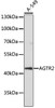 Western blot analysis of extracts of A-549 cells using AGTR2 Polyclonal Antibody at dilution of 1:1000.