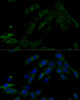 Immunofluorescence analysis of C6 cells using ATP6V0C Polyclonal Antibody at dilution of  1:100 (40x lens). Blue: DAPI for nuclear staining.