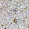 Immunohistochemistry of paraffin-embedded Mouse spinal cord using FKBP1B Polyclonal Antibody at dilution of  1:100 (40x lens).