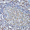 Immunohistochemistry of paraffin-embedded Human colon using CXCR1 Polyclonal Antibody at dilution of  1:100 (40x lens).