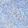 Immunohistochemistry of paraffin-embedded Mouse spleen using CXCR1 Polyclonal Antibody at dilution of  1:100 (40x lens).