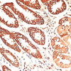 Immunohistochemistry of paraffin-embedded Human stomach using KRT13 Polyclonal Antibody at dilution of  1:100 (40x lens).
