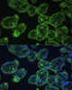 Immunofluorescence analysis of Human placenta using KRT13 Polyclonal Antibody at dilution of  1:100 (40x lens). Blue: DAPI for nuclear staining.