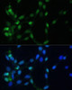 Immunofluorescence analysis of NIH-3T3 cells using MAD2L1 Polyclonal Antibody at dilution of  1:100 (40x lens). Blue: DAPI for nuclear staining.