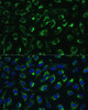 Immunofluorescence analysis of U-2 OS cells using MTIF2 Polyclonal Antibody at dilution of  1:100 (40x lens). Blue: DAPI for nuclear staining.