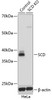 Western blot analysis of extracts from normal (control) and SCD knockout (KO) HeLa cells using SCD Polyclonal Antibody at dilution of 1:1000.