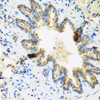 Immunohistochemistry of paraffin-embedded Rat lung using DEFB4A Polyclonal Antibody at dilution of  1:100 (40x lens).