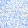 Immunohistochemistry of paraffin-embedded Rat spleen using CD11A Polyclonal Antibody at dilution of  1:100 (40x lens).