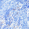 Immunohistochemistry of paraffin-embedded Mouse spleen using CD11A Polyclonal Antibody at dilution of  1:100 (40x lens).