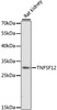 Western blot analysis of extracts of Rat kidney using TNFSF12 Polyclonal Antibody at dilution of 1:1000.