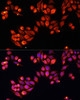 Immunofluorescence analysis of HeLa cells using Heparanase 1 Polyclonal Antibody at dilution of  1:100. Blue: DAPI for nuclear staining.