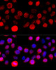 Immunofluorescence analysis of HeLa cells using BAZ1A Polyclonal Antibody at dilution of  1:100 (40x lens). Blue: DAPI for nuclear staining.