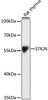 Western blot analysis of extracts of Rat thymus using STK26 Polyclonal Antibody at dilution of 1:1000.