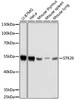 Western blot analysis of extracts of various cell lines using STK26 Polyclonal Antibody at dilution of 1:1000.