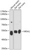 Western blot analysis of extracts of various cell lines using NR5A1 Polyclonal Antibody at dilution of 1:3000.
