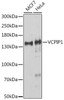 Western blot analysis of extracts of various cell lines using VCPIP1 Polyclonal Antibody at dilution of 1:1000.