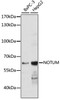 Western blot analysis of extracts of various cell lines using NOTUM Polyclonal Antibody at dilution of 1:1000.