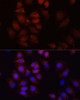 Immunofluorescence analysis of HeLa cells using HRNR Polyclonal Antibody at dilution of  1:100 (40x lens). Blue: DAPI for nuclear staining.