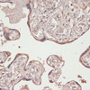 Immunohistochemistry of paraffin-embedded Human placenta using TXNRD1 Polyclonal Antibody at dilution of  1:100 (40x lens).