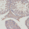Immunohistochemistry of paraffin-embedded Mouse testis using TXNRD1 Polyclonal Antibody at dilution of  1:100 (40x lens).