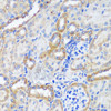 Immunohistochemistry of paraffin-embedded Mouse kidney using ERK1 / ERK2 Polyclonal Antibody at dilution of  1:200 (40x lens).