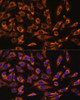 Immunofluorescence analysis of U-2 OS cells using ERK1 / ERK2 Polyclonal Antibody at dilution of  1:100 (40x lens). Blue: DAPI for nuclear staining.