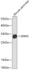 Western blot analysis of extracts of Mouse pancreas using SFRP5 Polyclonal Antibody at dilution of 1:1000.