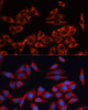 Immunofluorescence analysis of HeLa cells using MAPK1/MAPK3 Polyclonal Antibody at dilution of  1:100 (40x lens). Blue: DAPI for nuclear staining.