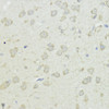 Immunohistochemistry of paraffin-embedded Rat brain using CCNB1 Polyclonal Antibody at dilution of  1:100 (40x lens).