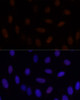 Immunofluorescence analysis of U-2 OS cells using GLI2 Polyclonal Antibody at dilution of  1:100. Blue: DAPI for nuclear staining.