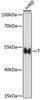 Western blot analysis of extracts of H460 cells using T Polyclonal Antibody at dilution of 1:1000.