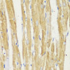 Immunohistochemistry of paraffin-embedded Rat heart using TOM20 Polyclonal Antibody at dilution of  1:100 (40x lens).