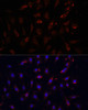 Immunofluorescence analysis of C6 cells using NFKBIA Polyclonal Antibody at dilution of  1:100. Blue: DAPI for nuclear staining.