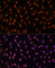 Immunofluorescence analysis of C6 cells using P70 S6K Polyclonal Antibody at dilution of  1:100. Blue: DAPI for nuclear staining.