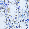 Immunohistochemistry of paraffin-embedded Human stomach using VIL1 Polyclonal Antibody at dilution of  1:100 (40x lens).