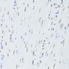 Immunohistochemistry of paraffin-embedded Mouse esophagus using HNRNPK Polyclonal Antibody at dilution of  1:200 (40x lens).