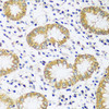 Immunohistochemistry of paraffin-embedded Human stomach using CADPS Polyclonal Antibody at dilution of  1:100 (40x lens).