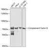 Western blot analysis of extracts of various cell lines using Complement Factor B Polyclonal Antibody at dilution of 1:1000.