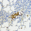 Immunohistochemistry of paraffin-embedded Mouse lung using Complement Factor B Polyclonal Antibody at dilution of  1:200 (40x lens).