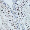 Immunohistochemistry of paraffin-embedded Rat testis using NR1I3 Polyclonal Antibody at dilution of  1:200 (40x lens).